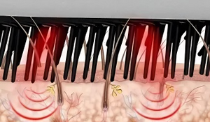 Cepillo Anticaída con LED Terapia y Vibración CAPILUX
